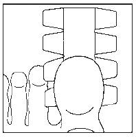 Schematic drawing depicting the spine with labeled vertebrae and a human head and neck silhouette from the front or back view