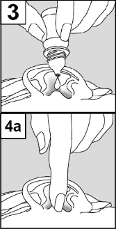 Illustrazione esplicativa che mostra una goccia di farmaco che cade da un erogatore nell'apertura di un dispositivo medico e un dito che preme un elemento nel passaggio 4a