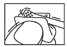 Schematic illustration showing a hand holding and applying a medical device to the upper body or hip area of a patient