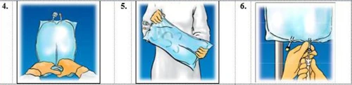 Tre pannelli illustrativi delle istruzioni: 4. mani che tengono una borsa con liquido, 5. una persona che solleva la borsa, 6. mani che collegano una siringa alla valvola della borsa
