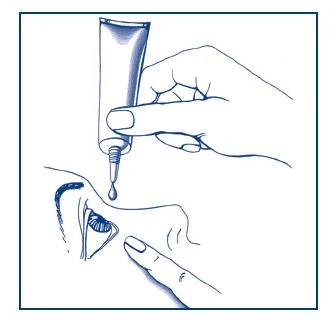 Mano che tiene un tubetto di medicinale, da cui esce una goccia direttamente nell'occhio di una persona raffigurata di profilo sotto forma di bozzetto blu