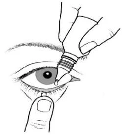 Mano sosteniendo un pequeño frasco de gotas, aplicando una gota del medicamento en el ojo, mientras la otra mano tira suavemente del párpado inferior