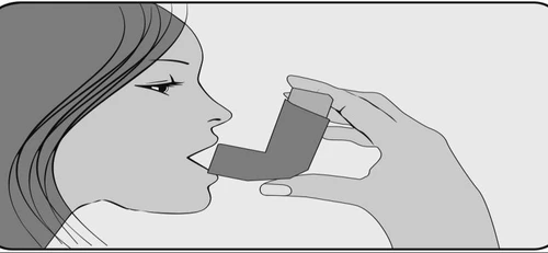 Profile of a woman using an inhaler, holding the device in her hands and placing the mouthpiece into her open mouth to take the medication