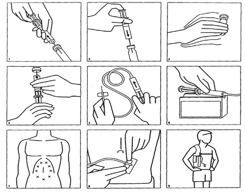 Una serie di nove diagrammi illustrativi che mostrano la preparazione della siringa, il collegamento con l'ago, il prelievo del farmaco e la sua somministrazione nell'addome