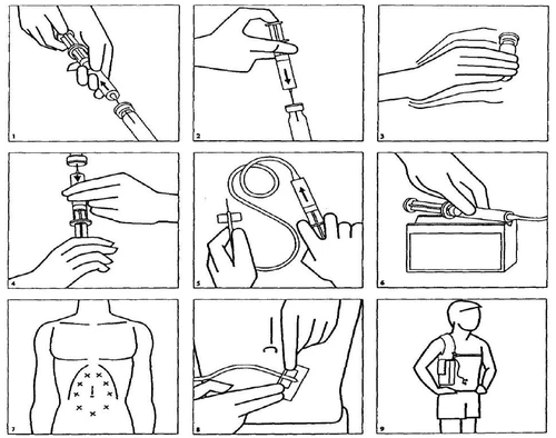 Serie di nove diagrammi illustrativi che mostrano la preparazione della siringa, la rimozione dell'ago, il riempimento dalla fiala e la somministrazione del farmaco nell'addome