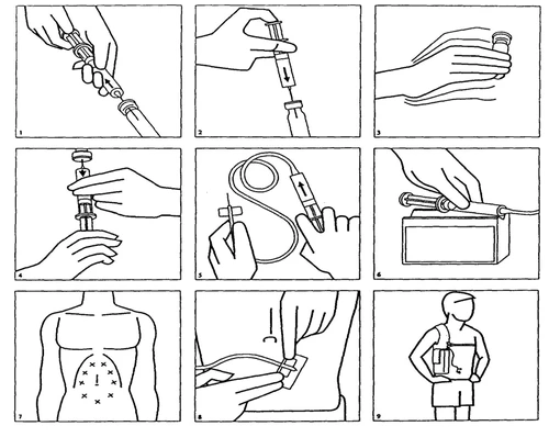 Serie de nueve diagramas instructivos que muestran la preparación de la jeringa, la extracción del medicamento, la punción del abdomen y la forma de administrar la dosis por vía subcutánea