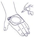 Disegno che mostra una mano con un cerotto quadrato applicato sul dorso, con un'area circolare evidenziata da una linea tratteggiata e i numeri 10 e 12