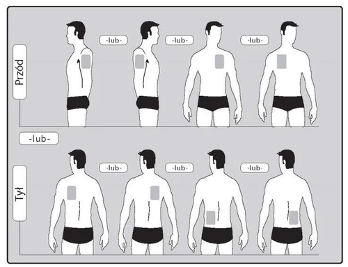 Schema che mostra diversi punti di somministrazione del farmaco sulla parte anteriore e posteriore del tronco di un uomo, compresi il braccio, il torace e i lati dell'addome