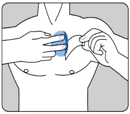 Due mani che applicano un cerotto rotondo di colore blu sul torace di un uomo, nella zona del collo e del torace