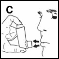 Ilustración que muestra una mano sosteniendo un inhalador cerca de la boca y la nariz de una persona, preparándose para inhalar el medicamento