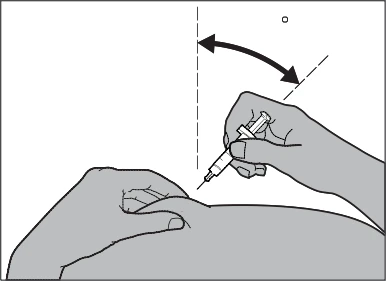Mano che impugna una siringa inclinata ad un angolo indicato da una linea tratteggiata e da una freccia nera sopra la spalla del paziente