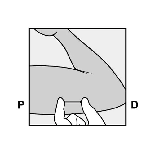 Hand holding a thin needle or applicator, applying it to the lower part of the arm for drug administration, black-and-white schematic with letters P and D