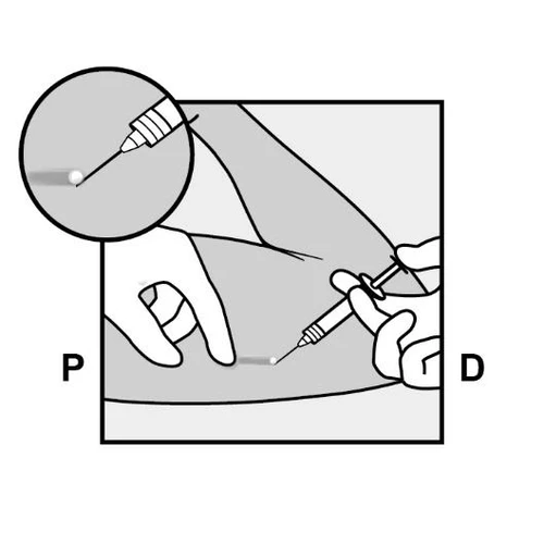 Hand holding a syringe inserting a needle into the thigh, magnified view of needle tip and letter designations P and D on sides of the drawing
