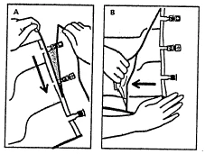 Instructional diagram in two steps A and B showing hands applying and pressing a medical patch onto the patient's skin