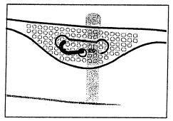 Schematic cross-section of tissue showing visible cells and a dark, winding line resembling a blood vessel or biological structure