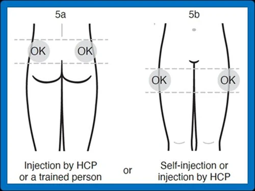 Diagram 5a shows an intramuscular injection into the buttock marked as OK, and diagram 5b shows an abdominal injection marked as OK for administration by a healthcare professional or patient