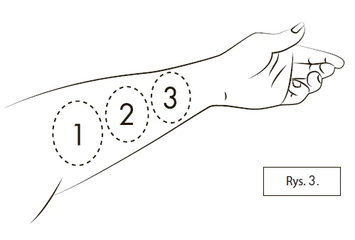 Schematic line drawing of a human hand with three numbered markers 1, 2, and 3 placed inside dashed circles on the forearm next to the label Fig. 3