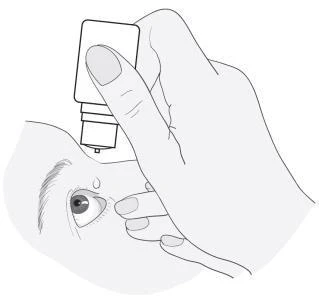 A hand holding a small bottle, bringing its dropper close to a person's eye, preparing to administer medication directly into the eye