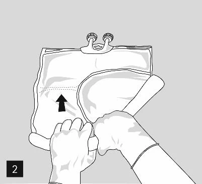 Manos con guantes sosteniendo una bolsa de fluido médico, una flecha negra apuntando hacia arriba indica la dirección de manipulación de la bolsa