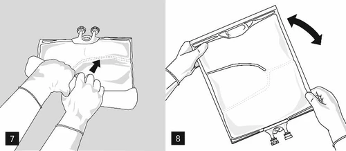 Gloved hands squeezing a fluid bag, then two hands holding it vertically and tilting it sideways according to the direction of the arrow