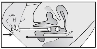 A schematic cross-section of the nasopharynx showing an applicator being inserted into the interior of the nose along the floor indicated by black arrows