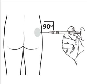 Mano che tiene la siringa ad un angolo di 90 gradi rispetto al gluteo, pronta a eseguire un'iniezione nell'area grigia evidenziata