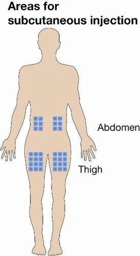 Schema della silhouette di una persona con quadrati blu che indicano le aree per iniezioni sottocutanee sull'addome e sui fianchi