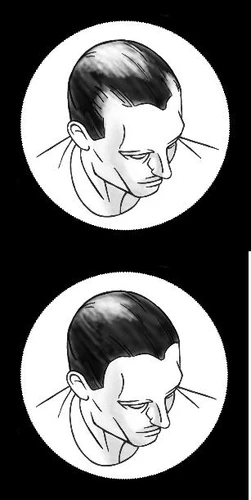 Two black-and-white line drawings depicting the head and shoulders of a man looking downward, placed within white circles on a black background