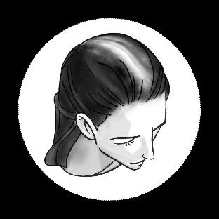 Black-and-white illustration showing a woman's head in profile, with visible light patches on the scalp, forehead, and cheek