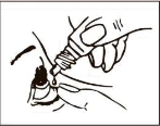 Mano sosteniendo un pequeño frasco de gotas, aplicando medicamento directamente en el ojo de una persona que sujeta suavemente el párpado inferior