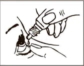 Mano che tiene una piccola boccetta con gocce, applicando il medicinale direttamente nell'occhio di una persona che delicatamente abbassa la palpebra inferiore