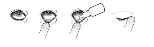 Diagram of eye drop administration instructions: open eye, pulling down the lower eyelid with a finger, instilling drops from the bottle, and closed eye after the procedure