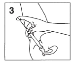 Mano con le dita che tirano la pelle verso l'alto, preparando il sito intramuscolare sul gluteo per l'iniezione mediante siringa