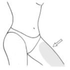 Schematic line drawing of a woman's torso and hip with a gray area marked on the thigh, indicated by a white arrow