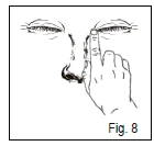 Illustration showing a person's face with an index finger pointing to the inner corner of the eye, suggesting the site for medication application or indicating a symptom