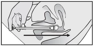Hand holding an applicator and inserting it into the patient's oral cavity along an arrow indicating the direction of movement toward the throat