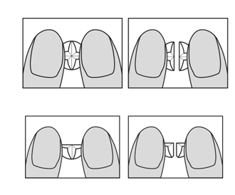 Four diagrams showing fingers holding a small, angular object in various positions and degrees of grip between the fingertips