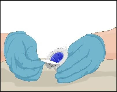 Mani con guanti medici blu tengono e aprono una confezione bianca contenente una compressa o capsula blu