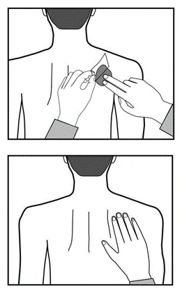 Diagram illustrating patch application on a person's back, first showing hands holding it in place, then a hand smoothing the patch surface on the skin