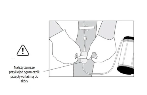 Manos con guantes fijando un limitador de flujo blanco al cuerpo mediante una cinta adhesiva, con un tubo y un recipiente con medicamento visibles al lado, así como una señal de advertencia