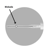 Schematic illustration of a syringe with a black arrow pointing to a small white square inside the thin needle labeled 'Blockage'