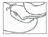 Disegno anatomico schematico che mostra una sezione trasversale del ginocchio con ossa, cartilagine, legamenti e tessuti molli visibili