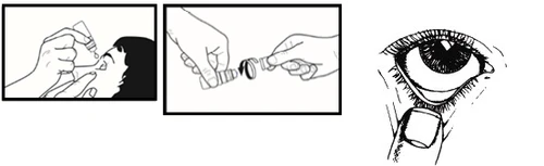 Three illustrations showing the application of eye drops, opening a small bottle with medication, and administering the preparation into the lower eyelid