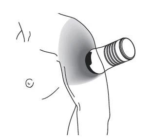 Schematic illustration of torso and arm with injection site marked in the groin area using a cylindrical applicator