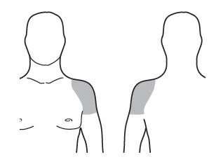 Schematic outlines of a male figure from front and side views, with a highlighted gray area on the upper arm and deltoid muscle