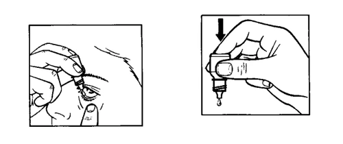 Two illustrations showing a hand holding a small bottle of eye drops and administering medication to the eye while gently pulling down the lower eyelid