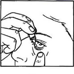 Mano sosteniendo un pequeño frasco con gotas, aplicando el medicamento directamente en el ojo de una persona cuyo párpado inferior se ha separado suavemente hacia abajo