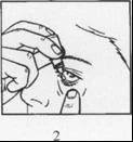 Mano que sostiene un pequeño frasco y aplica gotas en el canto inferior del ojo abierto de una persona en primer plano de perfil