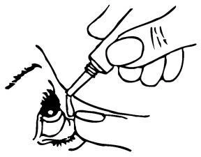 A hand holds a small bottle with a dropper and applies drops directly into a person's eye, with visible eyelashes and eyelid