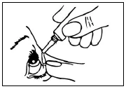 Una mano sostiene un pequeño frasco con aplicador, administrando gotas del medicamento directamente en el ojo de una persona que mira hacia arriba